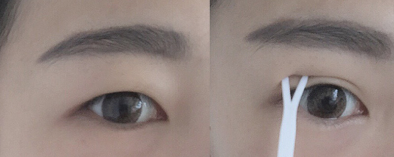 Ƥô˫Ƥ