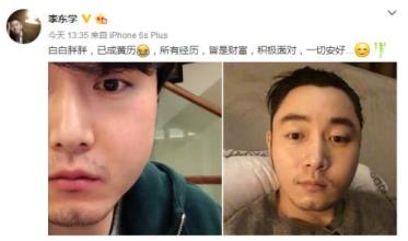 果郡王李东学拍戏毁容照曝光,与叶璇分手真相及现任妻子身份揭秘