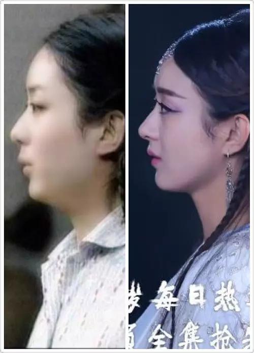 赵丽颖的鼻子整容过吗 丽颖的鼻子越来越高图