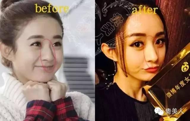 赵丽颖的鼻子整容过吗 丽颖的鼻子越来越高图