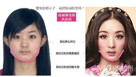 赵丽颖的鼻子整容过吗 丽颖的鼻子越来越高图