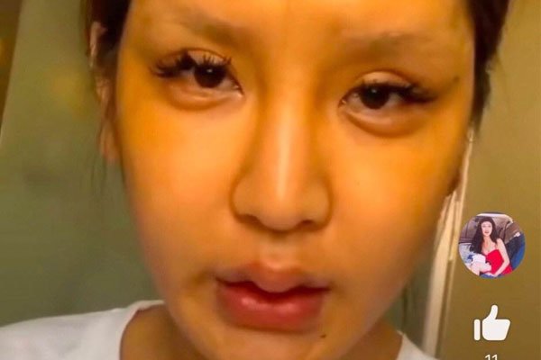 桃花宝宝是变性人吗 她对自己“狠”过了头